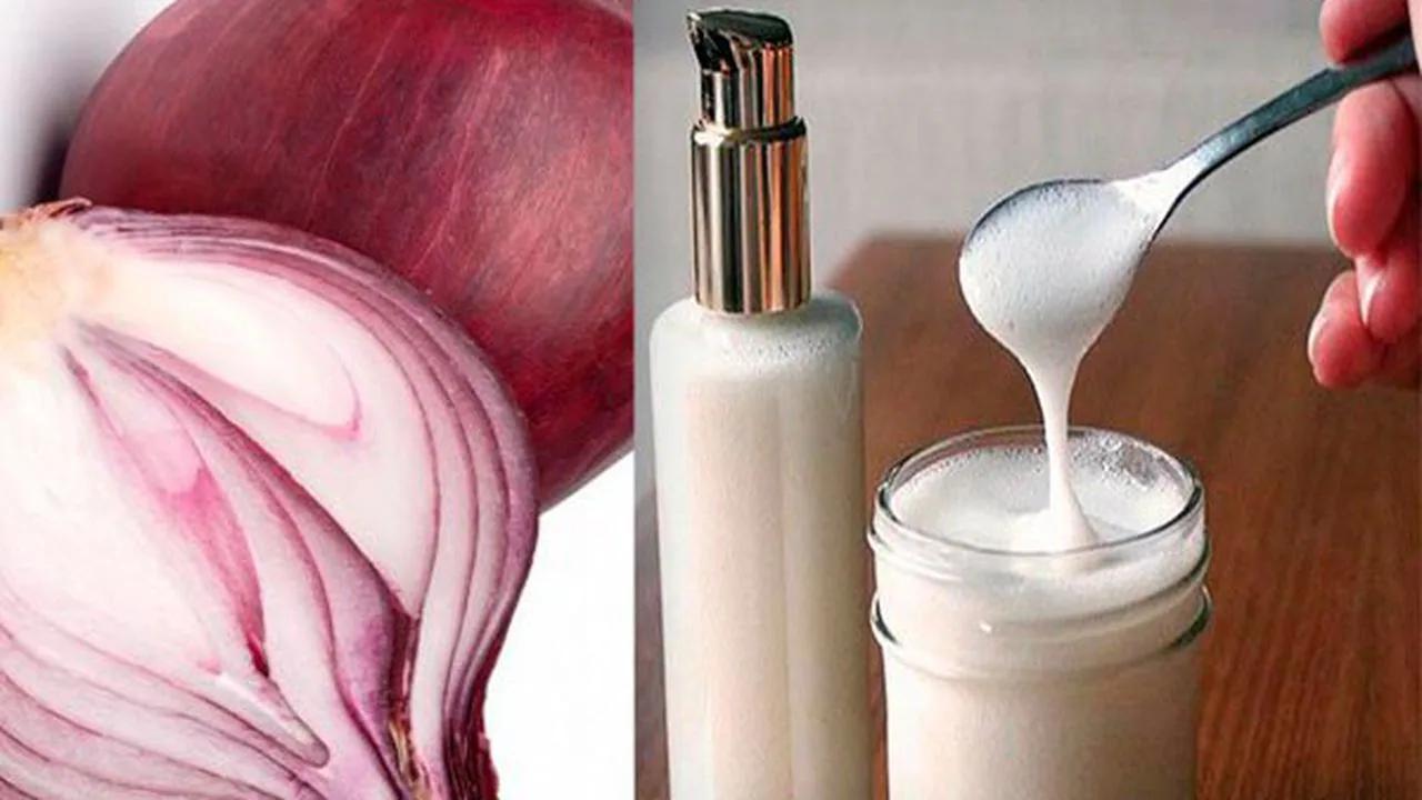 Jugo de cebolla para la calvicie: ¿realmente funciona? - Cuánto tiempo tarda en crecer el pelo con la cebolla jugo de cebolla para la calvicie - Cuánto tiempo tarda en crecer el pelo con la cebolla