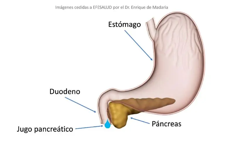 Dónde se produce la bilis y el jugo pancreático - Dónde se produce la bilis y el jugo pancreático donde se produce la bilis y el jugo pancreatico - Dónde se produce la bilis y el jugo pancreático