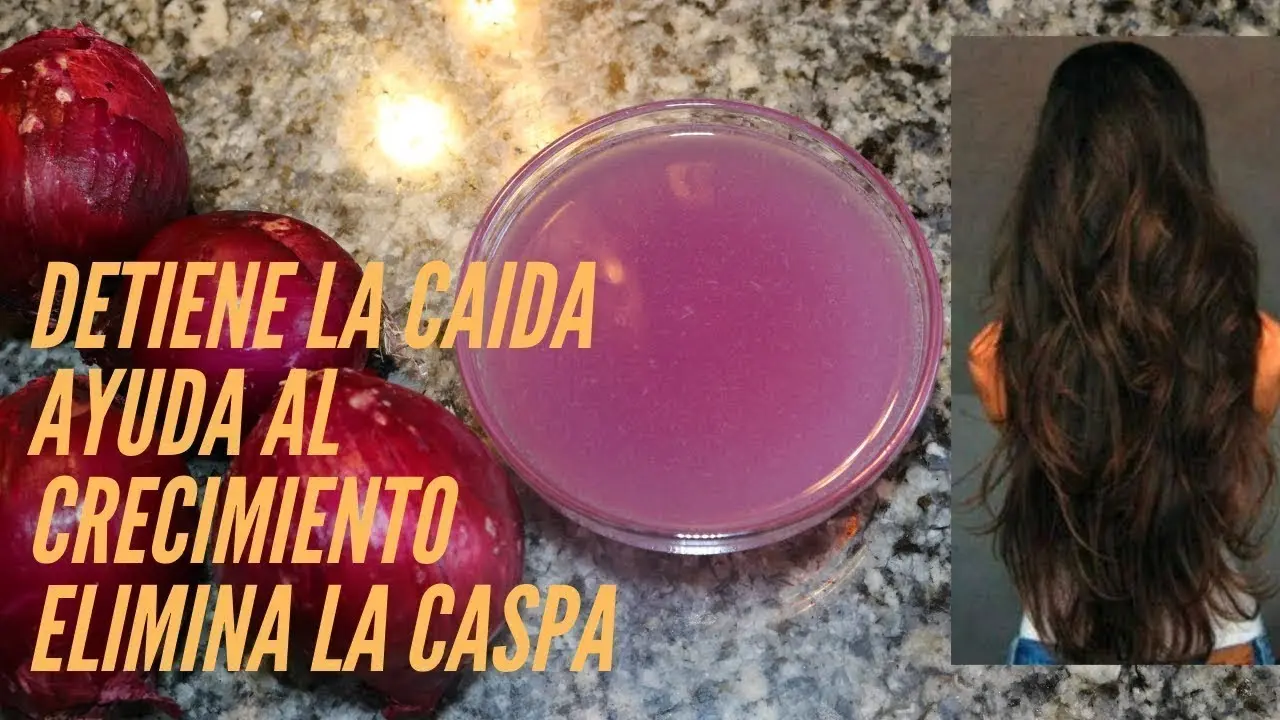 jugo de cebolla para la caspa - Qué pasa si le pongo jugo de cebolla a mi shampoo